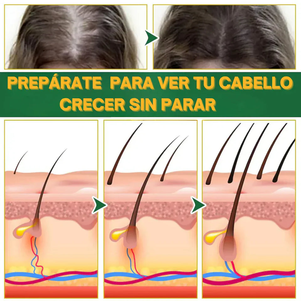 OUHOE -CRECIMIENTO DE CABELLO